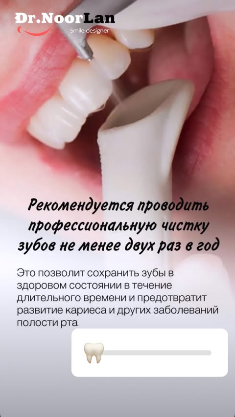 Рекомендации по уходу за зубами